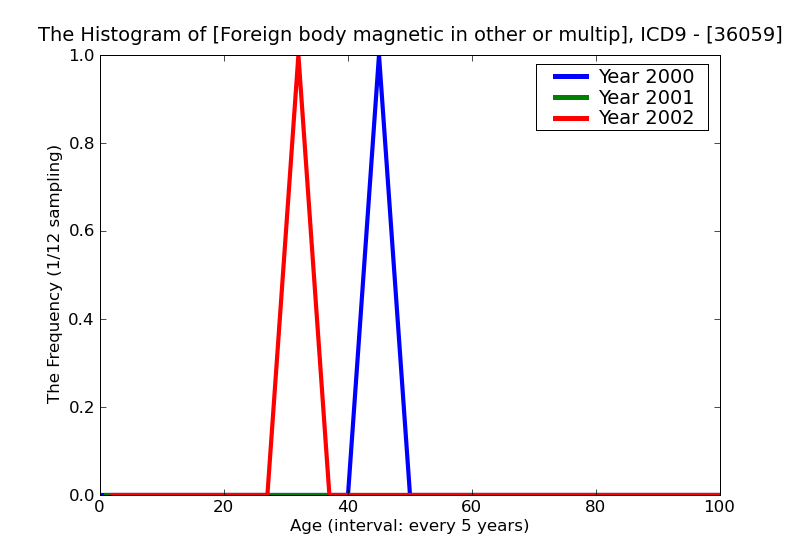 ICD9 Histogram Foreign body magnetic in other or multiple sites