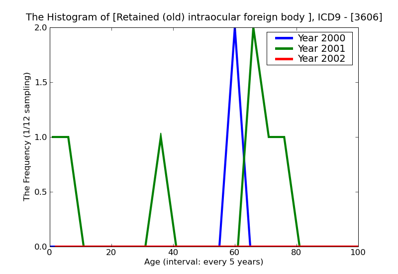 ICD9 Histogram Retained (old) intraocular foreign body nonmagnetic