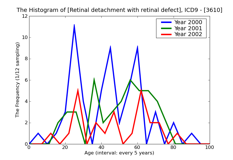 ICD9 Histogram Retinal detachment with retinal defect