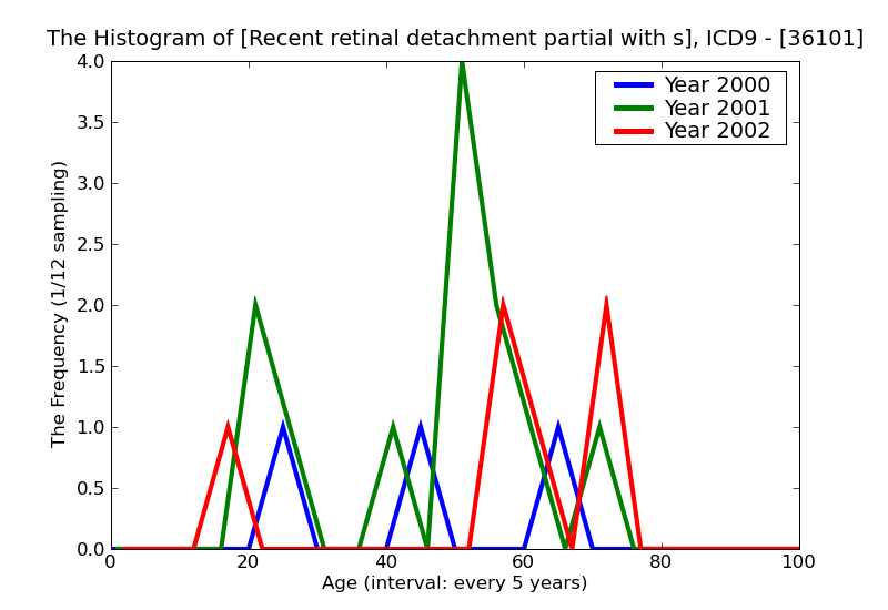 ICD9 Histogram Recent retinal detachment partial with single defect