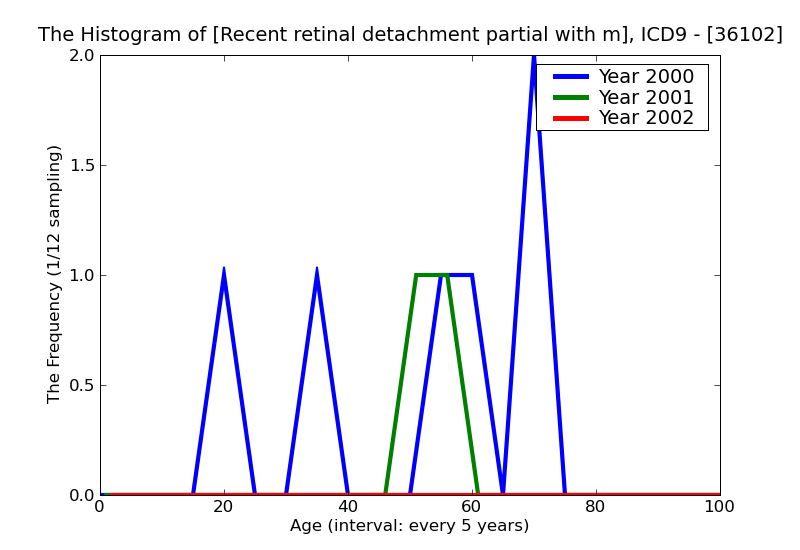 ICD9 Histogram Recent retinal detachment partial with multiple defects