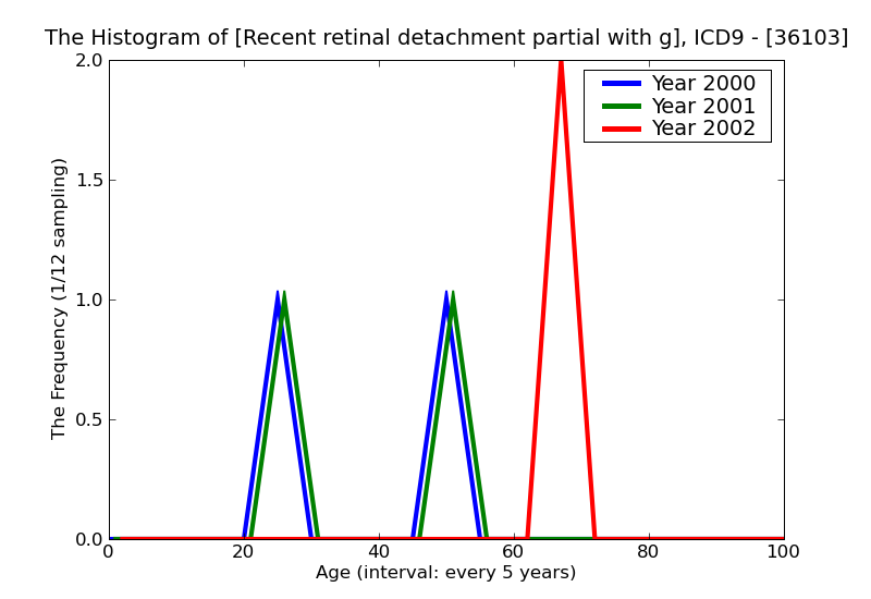 ICD9 Histogram Recent retinal detachment partial with giant tear