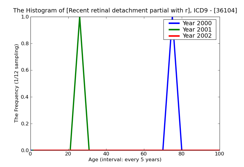 ICD9 Histogram Recent retinal detachment partial with retinal dialysis