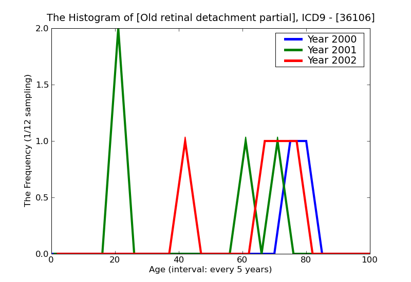 ICD9 Histogram Old retinal detachment partial