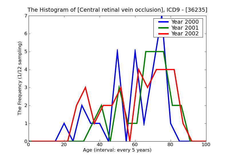 ICD9 Histogram Central retinal vein occlusion