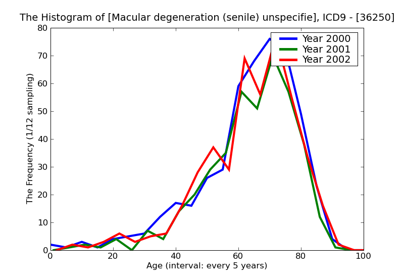 ICD9 Histogram Macular degeneration (senile) unspecified