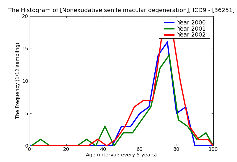 ICD9 Histogram Nonexudative senile macular degeneration of macular