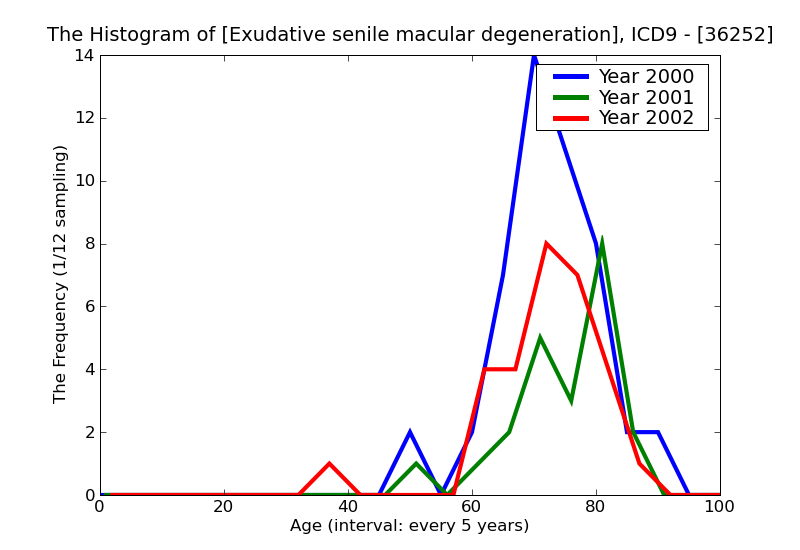 ICD9 Histogram Exudative senile macular degeneration
