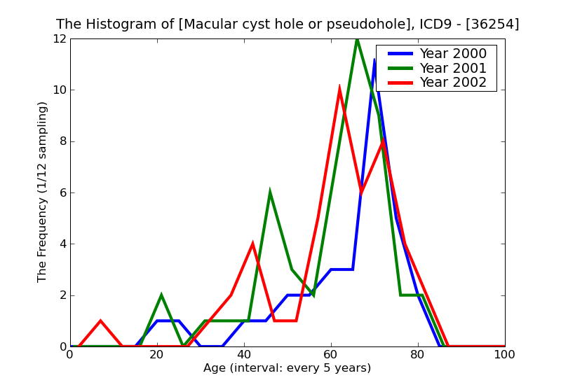 ICD9 Histogram Macular cyst hole or pseudohole