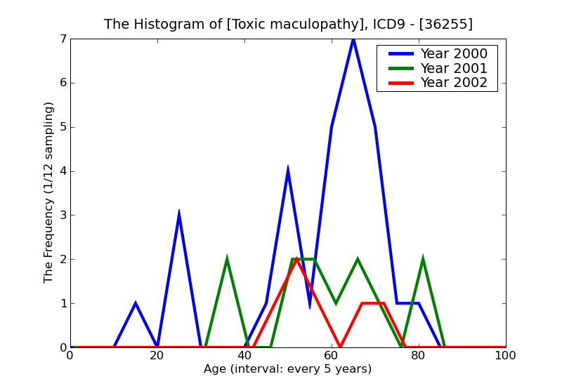 ICD9 Histogram Toxic maculopathy