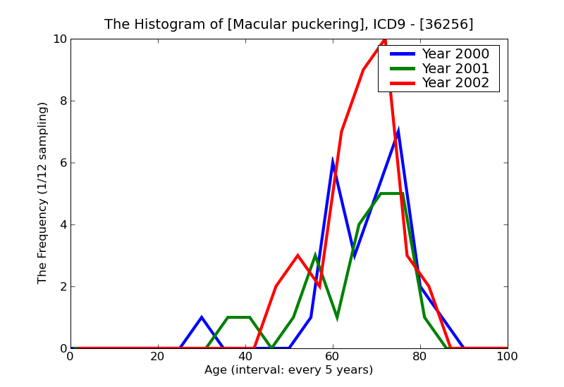 ICD9 Histogram Macular puckering