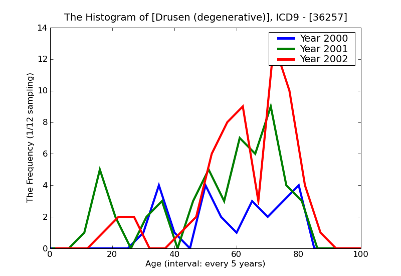 ICD9 Histogram Drusen (degenerative)