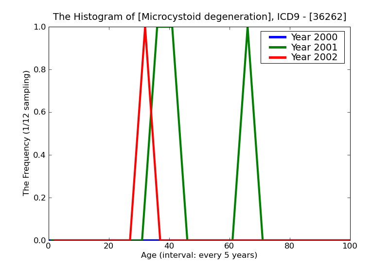 ICD9 Histogram Microcystoid degeneration