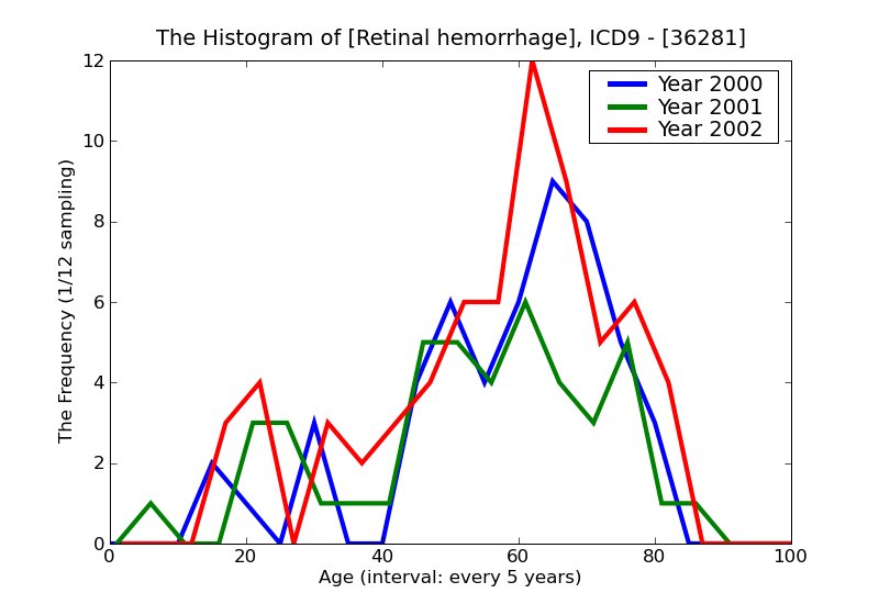 ICD9 Histogram Retinal hemorrhage