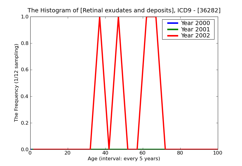 ICD9 Histogram Retinal exudates and deposits