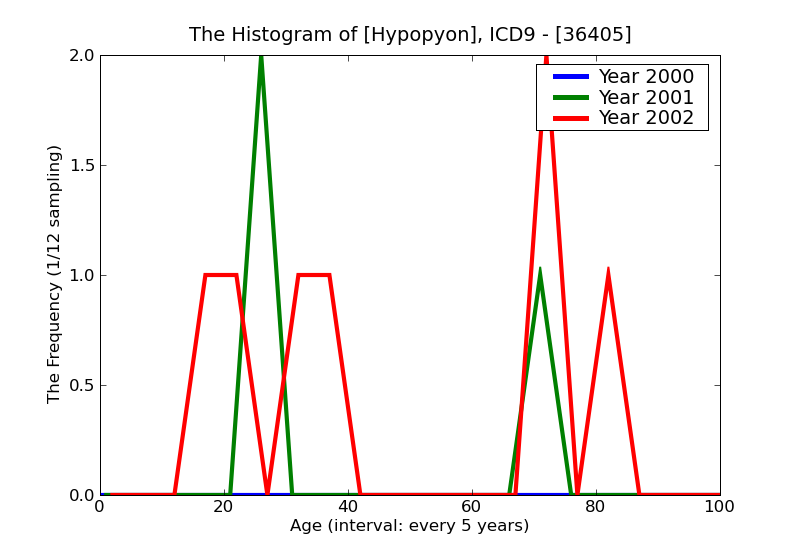 ICD9 Histogram Hypopyon