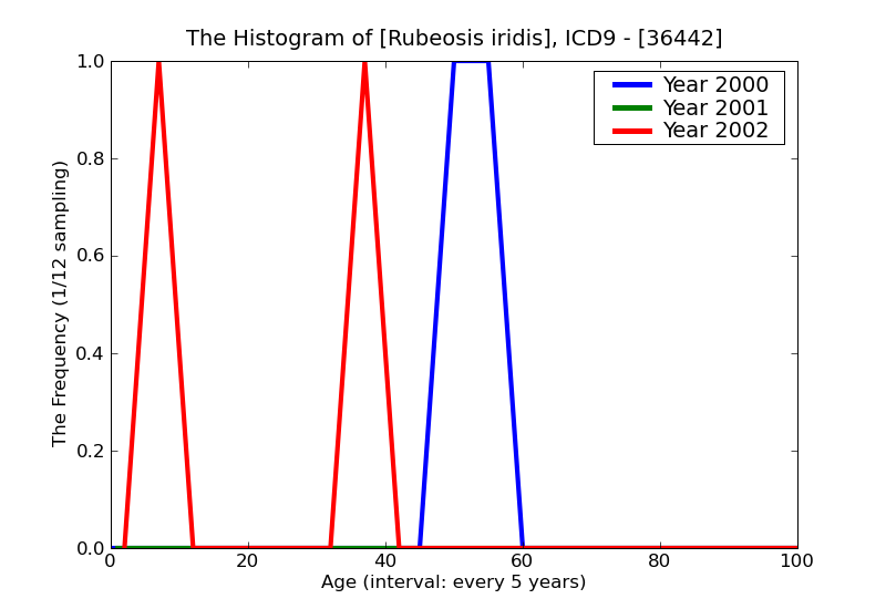 ICD9 Histogram Rubeosis iridis