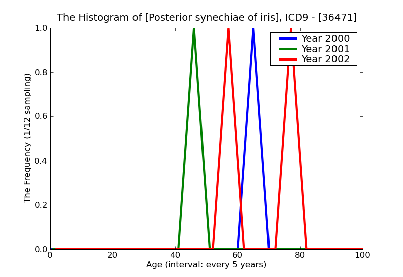 ICD9 Histogram Posterior synechiae of iris