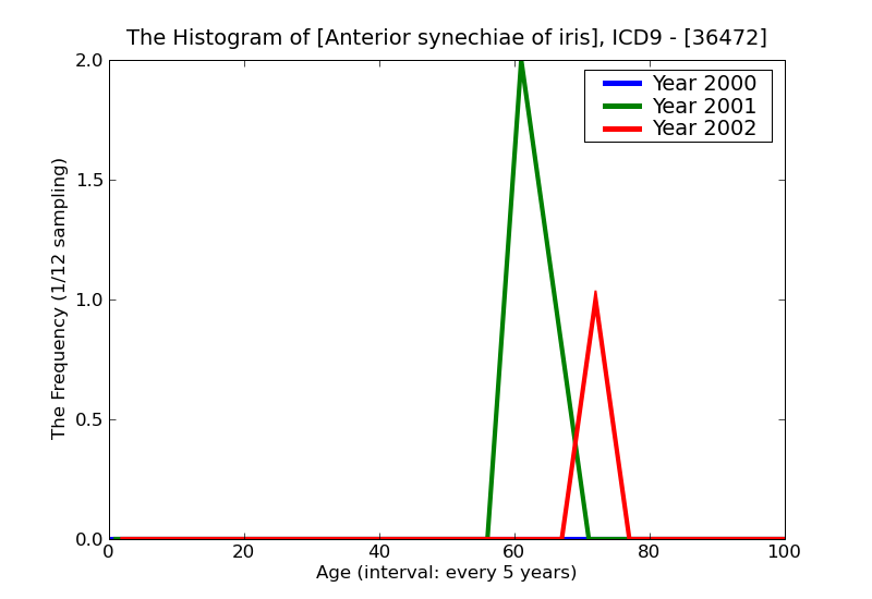 ICD9 Histogram Anterior synechiae of iris