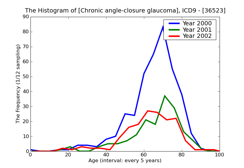 ICD9 Histogram Chronic angle-closure glaucoma