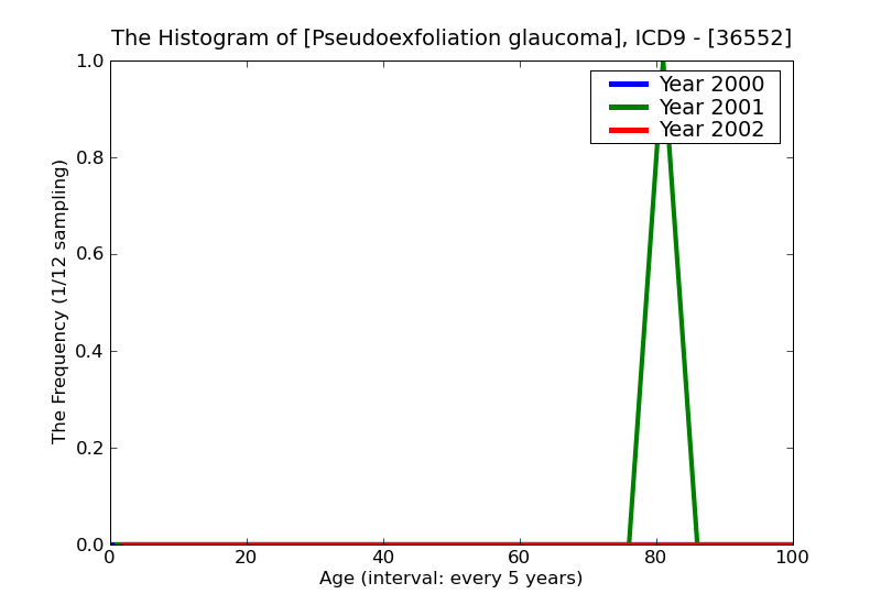 ICD9 Histogram Pseudoexfoliation glaucoma