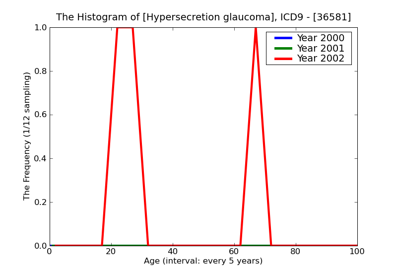ICD9 Histogram Hypersecretion glaucoma