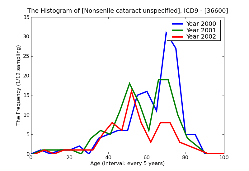 ICD9 Histogram Nonsenile cataract unspecified