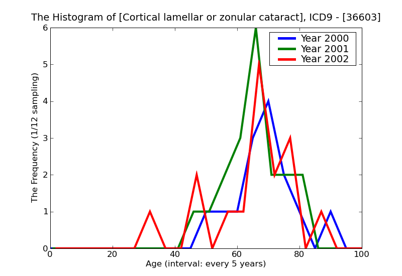 ICD9 Histogram Cortical lamellar or zonular cataract
