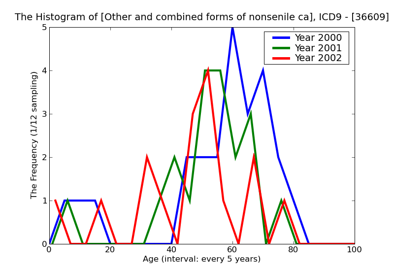 ICD9 Histogram Other and combined forms of nonsenile cataract