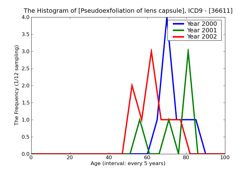 ICD9 Histogram Pseudoexfoliation of lens capsule