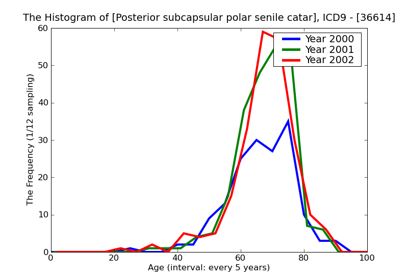 ICD9 Histogram Posterior subcapsular polar senile cataract