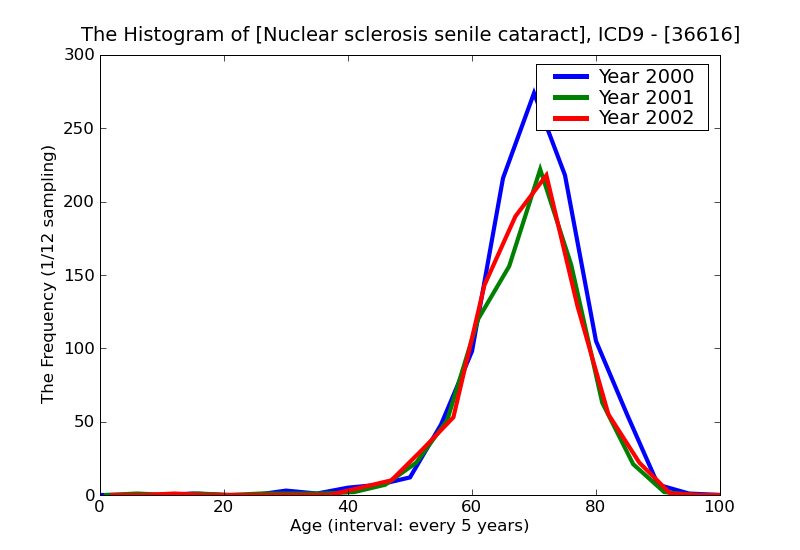 ICD9 Histogram Nuclear sclerosis senile cataract
