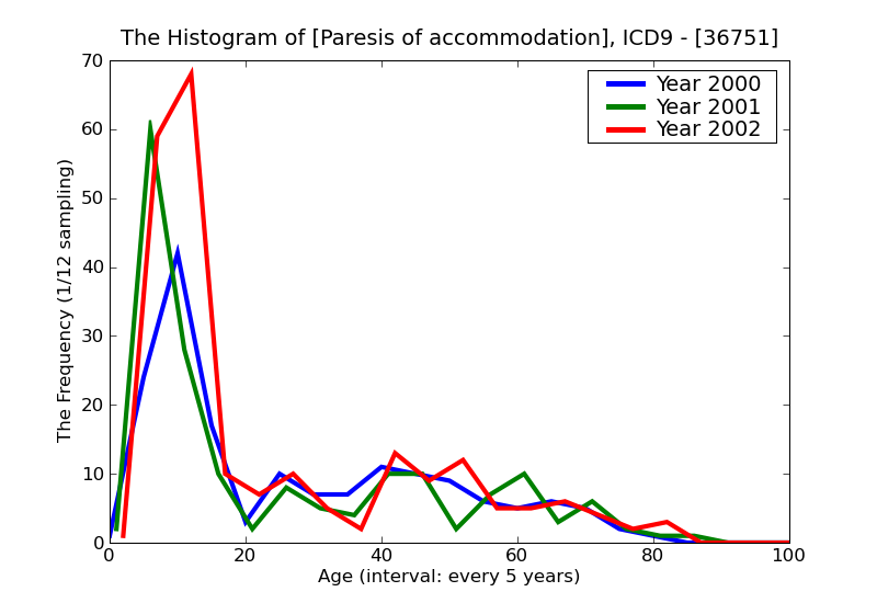 ICD9 Histogram Paresis of accommodation