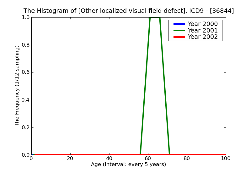 ICD9 Histogram Other localized visual field defect