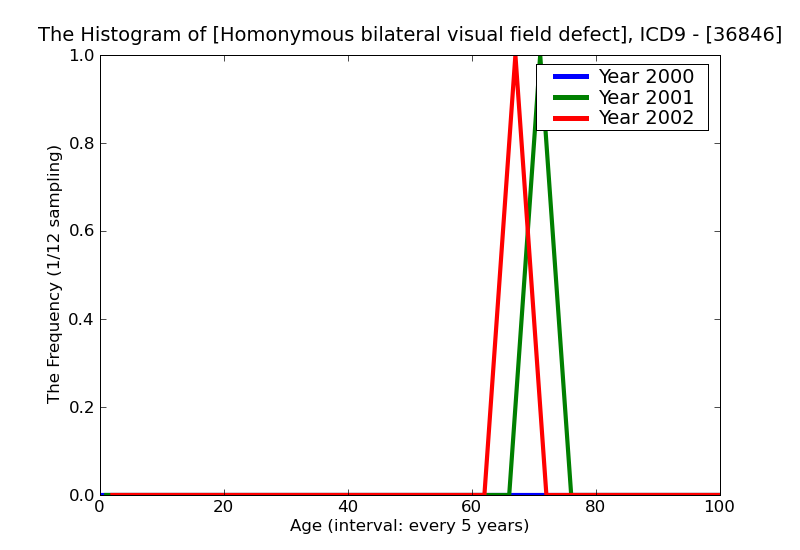 ICD9 Histogram Homonymous bilateral visual field defects