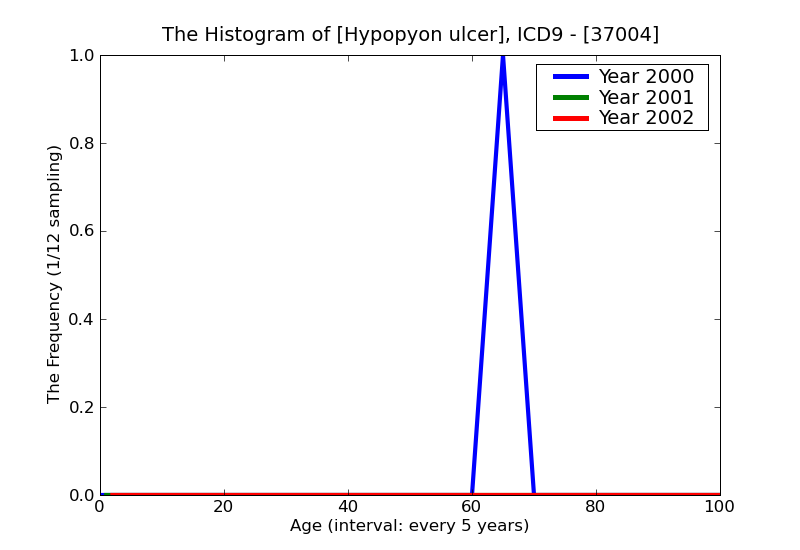 ICD9 Histogram Hypopyon ulcer