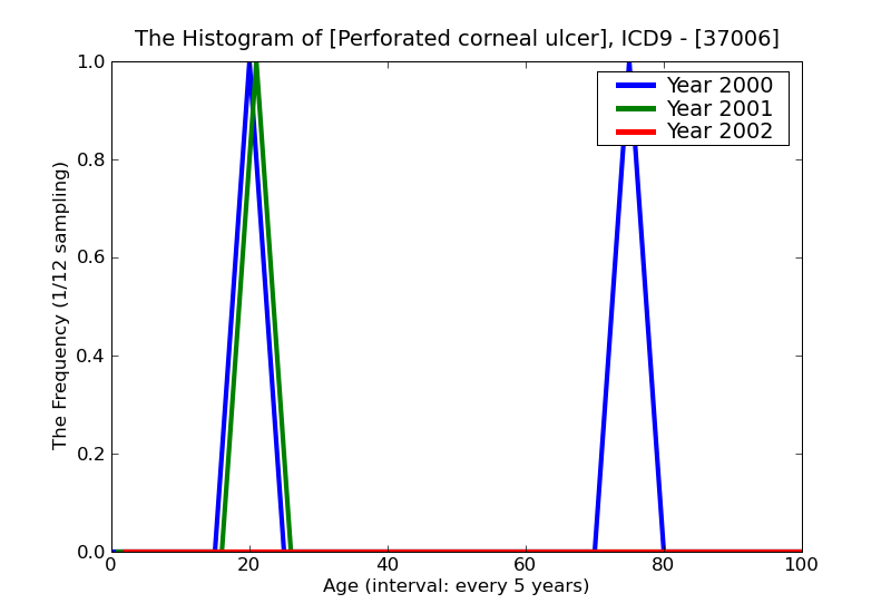 ICD9 Histogram Perforated corneal ulcer