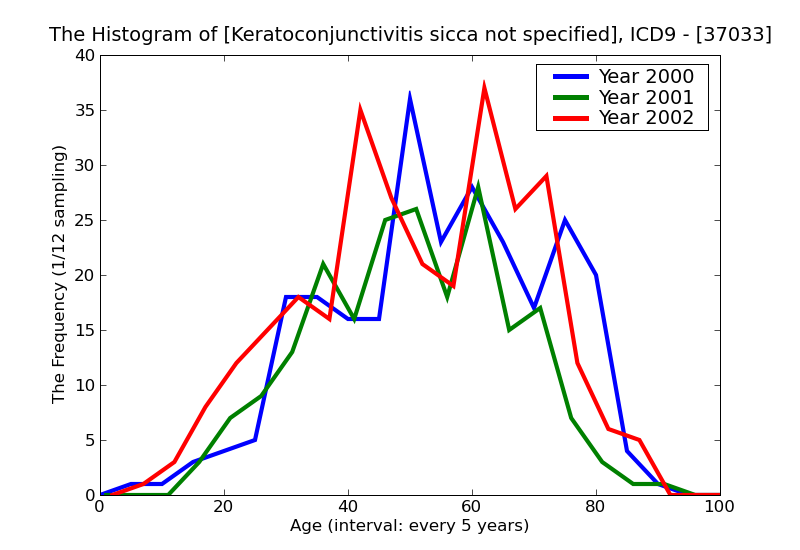 ICD9 Histogram Keratoconjunctivitis sicca not specified as Sjoren