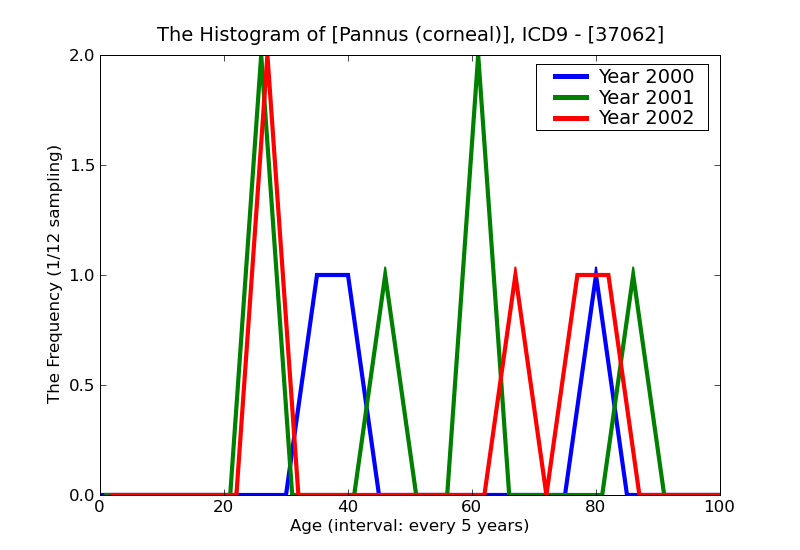 ICD9 Histogram Pannus (corneal)