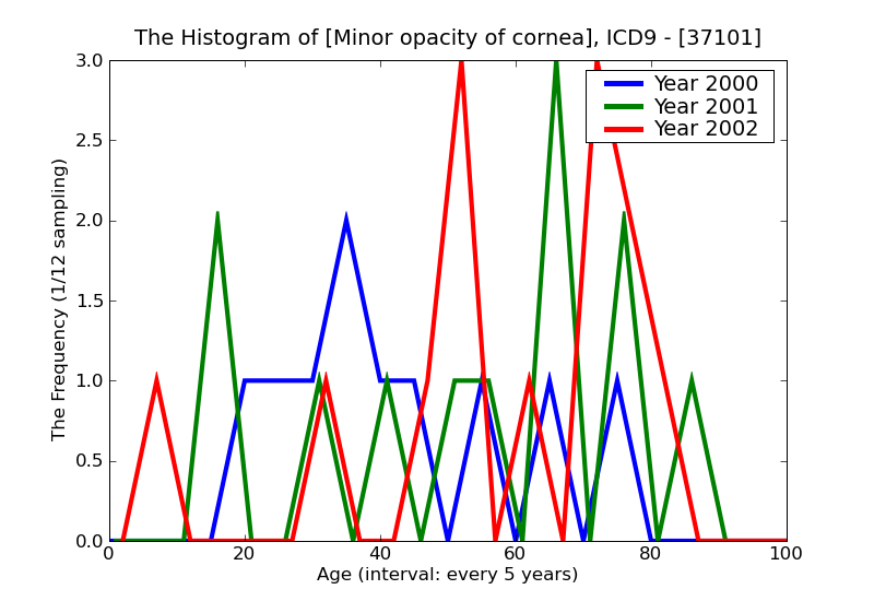 ICD9 Histogram Minor opacity of cornea