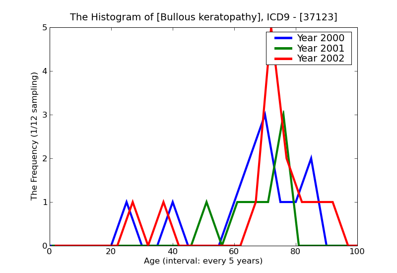 ICD9 Histogram Bullous keratopathy