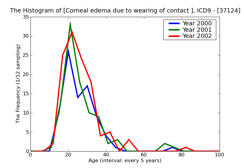 ICD9 Histogram Corneal edema due to wearing of contact lenses