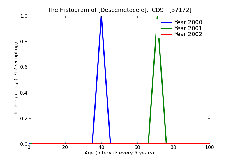 ICD9 Histogram Descemetocele