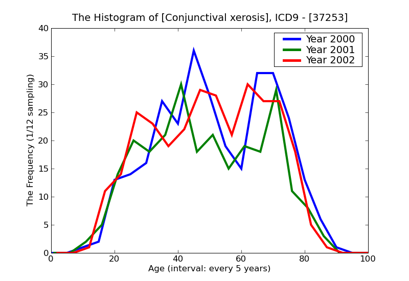 ICD9 Histogram Conjunctival xerosis
