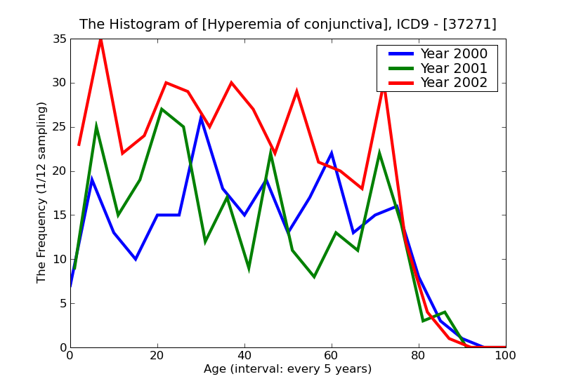 ICD9 Histogram Hyperemia of conjunctiva