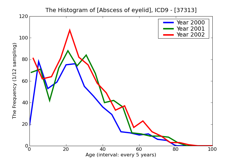 ICD9 Histogram Abscess of eyelid