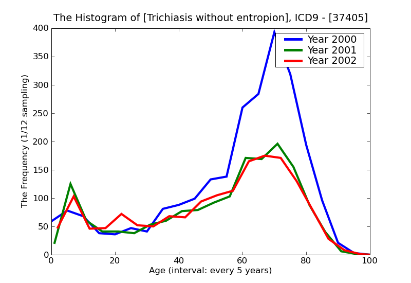 ICD9 Histogram Trichiasis without entropion