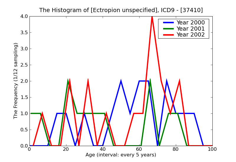 ICD9 Histogram Ectropion unspecified