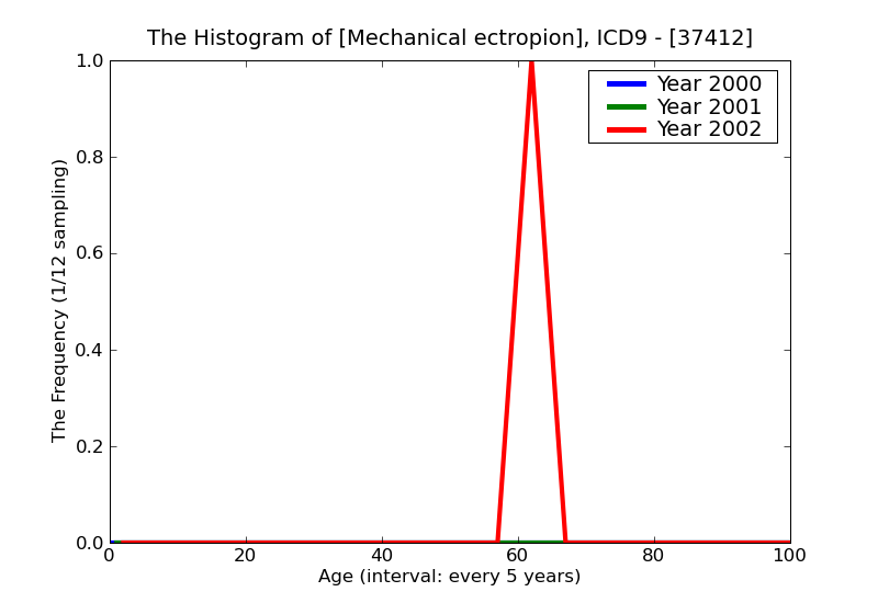 ICD9 Histogram Mechanical ectropion