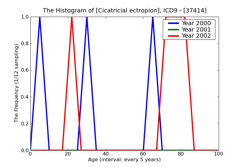 ICD9 Histogram Cicatricial ectropion